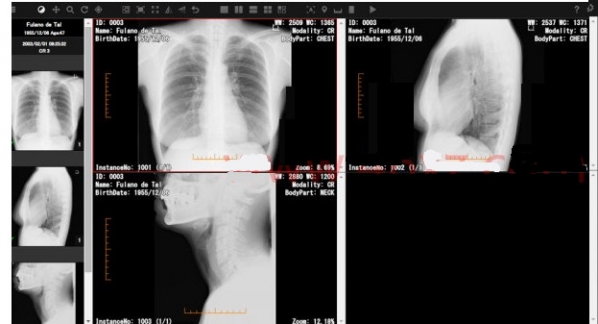 JIUNCorporationSonicDICOM(医学影像PACS软件)免费版下载_JIUNCorporationSonicDICOM(医学影像PACS软件)绿色版_JIUNCorporationS